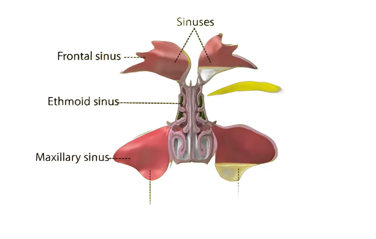 Sinusitis relief visualized with clear sinus passages in a cross-sectional head illustration.